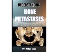 UNDERSTANDING BONE METASTASES: Clarity And Control Over Secondary Cancer Spread To The Skeleton-A Patient-Centered Guide To Symptoms, Imaging, ... Insight, And Confident Care Decisions