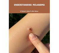 Understanding Melanoma: A Patient'S Guide To Skin Cancer