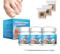 Ungüento para Hongos en las Uñas de Rápida Curación, Ungüento para Hongos en las Uñas, Arregla y Renueva sin Dolor las Uñas Dañadas y Quebradas, Fortalece y Restaura la Apariencia (3pcs)