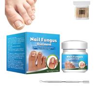 Ungüento para Hongos en las Uñas de Rápida Curación, Ungüento para Hongos en las Uñas, Arregla y Renueva sin Dolor las Uñas Dañadas y Quebradas, Fortalece y Restaura la Apariencia (1pcs)