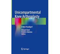 Unicompartmental Knee Arthroplasty: A New Paradigm?