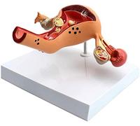 útero Ovario Vagina Humana Modelo anatómico anatómico Lesión Médico Modelo 1: 1 Demo Modelo Medica selección ginecológica para el tamaño