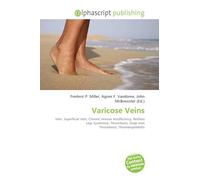 Varicose Veins: Vein, Superficial Vein, Chronic Venous Insufficiency, Restless Legs Syndrome, Thrombosis, Deep Vein Thrombosis, Thrombophlebitis