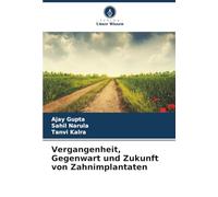 Vergangenheit, Gegenwart und Zukunft von Zahnimplantaten