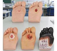 VILA SMO Juego De 5 Modelos De Pie Diabético, Simulador De Úlceras Patológicas De Grado 1 a 5, Modelo De Pie Humano, para La Enseñanza De Cuidados De Heridas, Demostraciones De Anatomía Y Fisiología