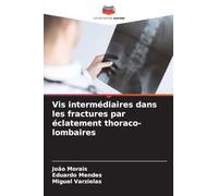Vis intermédiaires dans les fractures par éclatement thoraco-lombaires