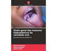 Visão geral dos tumores hiperplásicos da cavidade oral: pseudotumores da cavidade oral