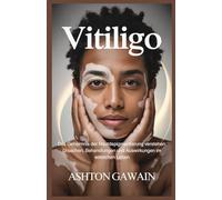 Vitiligo: Das Geheimnis der Hautdepigmentierung verstehen: Ursachen, Behandlungen und Auswirkungen im wirklichen Leben