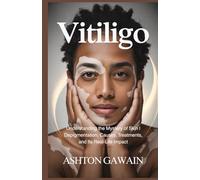Vitiligo: Understanding the Mystery of Skin Depigmentation, Causes, Treatments, and Its Real-Life Impact