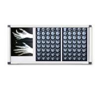 Vitrina De Rayos X Led Ultrafina, Iluminador De Películas Radiológicas Médicas De Montaje En Pared, Panel De Luz Brillante Simple/Doble/Triple para TC, RM, Negativos, Three Rows
