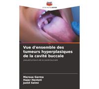 Vue d'ensemble des tumeurs hyperplasiques de la cavité buccale: pseudotumeurs de la cavité buccale