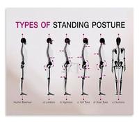 VWWJCCRO Bad Posture Back Disorder Classification Poster Standing Alignment Guide for Bedroom Study Room Wall-Art(Framed,08x12inch(20x30cm))