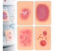 WADPP Juego de 4 Modelos Didácticos de Dermatología, Simulación Realista de Silicona para Infecciones Bacterianas (Celulitis, Impétigo, Foliculitis), Ayuda para Formación Médica y Enfermería
