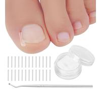 WeddHuis Juego de correctores para uñas encarnadas: 50 piezas de tiras alisadoras de uñas sin dolor con elevador de uñas y herramientas para uñas: kit de uñas y corrector de fácil uso