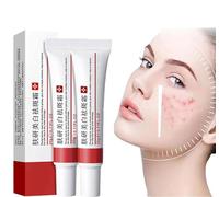 Whitening Freckle Cream, Acne Scar Removal Treatment Cream, Moisturizing Removes Facial Melasma Dark Spots Wrinkles Blemishes, Pigmentation Removal Cream Remove Dark Spots (1pcs)