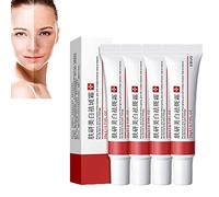 Whitening Freckle Cream,Acne Scar Removal Treatment Cream,Pigmentation Removal Cream For Face,Remove Melasma Acne Cream Fading Spot Cream,Dark Spot Corrector For Face (Whitening Freckle-4PCS)
