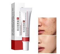 Whitening Freckle Cream,Acne Scar Removal Treatment Cream,Pigmentation Removal Cream,Moisturizing Removes Facial Melasma Dark Spots Wrinkles Blemishes (1)