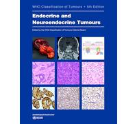 WHO Classification of Endocrine and Neuroendocrine Tumours 5th edition: Who Classification of Tumours