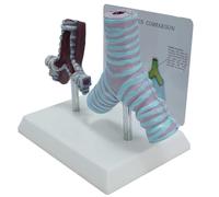 WHOOLEFUN Modelo De Anatomía Patológica De Bronquios Humanos, Modelo De Comparación De Bronquios Fumando Y Bronquios Saludables, con Tarjeta Trasera En Inglés, para Escuelas De Medicina, Hospitales