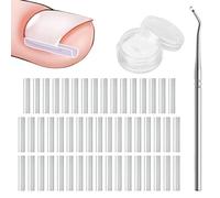 WOLMIK Juego de Corrector de Uñas Encarnadas - 50 PCS Tiras Enderezadoras de Uñas sin Dolor con Elevador de Uñas del Pie - Kit de Herramientas para Uñas Encarnadas de Fácil Uso