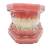 WOTZOV Modelo de demostración de ortodoncia tipodonto de 8 cm. Ideal para Fines educativos y de capacitación.，B 8cm
