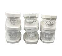 WOTZOV Modelo de Dientes de ortodoncia - Modelo de Diente tipodonto - Análisis de tipodontos dentales Puente de Dientes Corona Enseñanza Estudio Educación Dental，6 Pcs Set