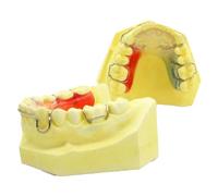 WOTZOV Modelo de Dientes estándar de tipodonto Dental. Retenedor de ortodoncia. Modelo comparativo de restauración Dental para Estudio. Modelo de enseñanza estándar pa，Natural 10cm