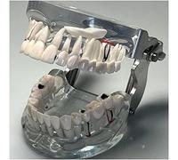 WOTZOV Modelo de patología Dental - Modelo Educativo Dental Modelo de Diente Humano - Modelo de patología Dental Transparente de Diente Humano - Modelo Dental de Boca