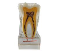 WOTZOV Modelo de patología Dental para la enseñanza del conducto radicular. Modelo de nervio Dental Seis Veces más Grande para la enseñanza Dental o el Cuidado bucal.