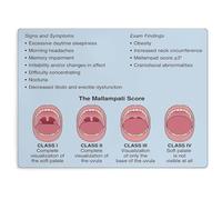 WVPJJNXAFN Obstructive Sleep Apnea Guide for Dentists Poster Canvas Print Wall Art for Dental Clinic Classroom Modern Decor(Framed,12x18inch(30x45cm))