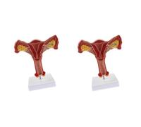 Wzxksoac 2X 1:1 Modelo de Trompas de Falopio de Ovario de ÚTero Femenino Humano Modelo AnatóMico de AnatomíA Herramientas de EnseñAnza