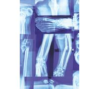 X-Ray Anatomy Notebook - 100 Pages of Graph Paper | Medical Student Journal, Science Lab Notebook, Anatomy Study & Math Grid Book: Unique Blue X-Ray ... Chemistry, Engineering, Graphing & Journaling