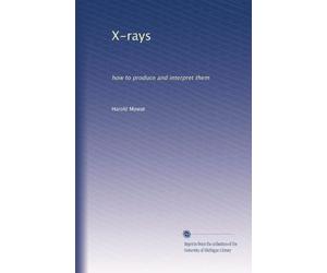 X-rays, how to produce and interpret them. 6