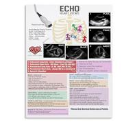 XGINERFEX Echocardiogram Views Poster Heart Ultrasound Imaging Guide Diagnostic Sonography Classroom Art(Framed,12x18inch(30x45cm))