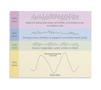 XGINERFEX EEG During Sleep Chart Brain Waves Study Guide Canvas Wall-Art for Neurology Office Decor(Framed,12x18inch(30x45cm))