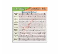 XGINERFEX EKG Interpretation Poster 12 Lead Quick Reference Heart Rhythm Knowledge Chart Canvas Art Nursing Education Wall Decor for Living Room(Framed,08x12inch(20x30cm))