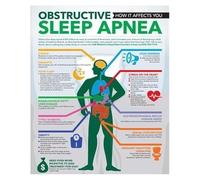 XGINERFEX Health Education Wall-Art: Sleep Apnea Explained - A Clean Modern Infographic on Canvas for Living Room, Pulmonary Office(Unframed,12x18inch(30x45cm))
