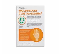 XGINERFEX Human Skin Anatomy Poster Molluscum Contagiosum Virus Educational Chart Canvas Print Wall-Art for Living Room Bedroom(Unframed,12X18inch(30X45cm))