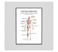 XGINERFEX Poor Posture Effects Poster Chiropractic Educational Wall-Art for Spinal Alignment Health Clinic Hospital Office Decor Canvas Print(Framed,16x24inch(40x60cm))