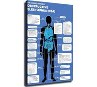 XGINERFEX Sleep Apnea Educational Chart Health Knowledge Guide Poster Wall-Art for Living Room Bedroom Office Kitchen(Framed,12x18inch(30x45cm))