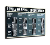 XGINERFEX Spinal Degeneration Chart Poster Canvas Print Chiropractic Educational Wall-Art for Office Clinic Waiting Room(Framed,08X12inch(20X30cm))