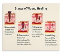 XGINERFEX Surgical Wound Poster Primary Intention Secondary Granulation Decor(Framed,08x12inch(20x30cm))