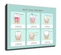 XGINERFEX Understanding Root Canals Health Educational Poster Oral Anatomy Chart for Clinic(Unframed,12x18inch(30x45cm))