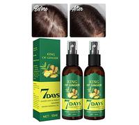 XIRUJNFD Shouga Kingu Hair Growth Oil - Spray con Jengibre Anti-Perdida Capilar (2Unid.)