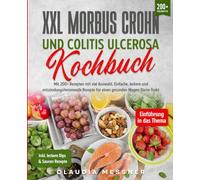 XXL Morbus Crohn und Colitis Ulcerosa Kochbuch: Mit 200+ Rezepten mit viel Auswahl. Einfache, leckere und entzündungshemmende Rezepte für einen gesunden Magen-Darm-Trakt