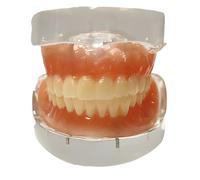 yeeplant 28 dientes extraíbles modelo completo de prótesis con base transparente, modelo de dientes adultos de resina, para estudio dental, comunicación del paciente, enseñanza oral