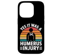 Yes It Was A Humerus Injury Broken Arm Recovery - Carcasa para iPhone 14 Pro