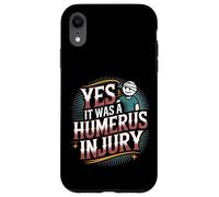 Yes It Was A Humerus Injury Broken Arm Recovery |- Carcasa para iPhone XR
