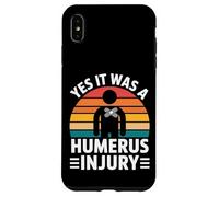 Yes It Was A Humerus Injury Broken Arm Recovery - Carcasa para iPhone XS MAX