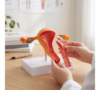 Yinhing Modelo de Anatomía del Reproductor Femenino Modelo de Trompas de Falopio de Ovario de útero de Tamaño Natural con Vasos de Folículos de Ovario Seccionados para el Aula de